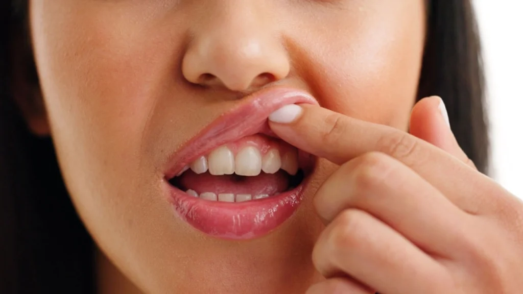 Fix gum disease early