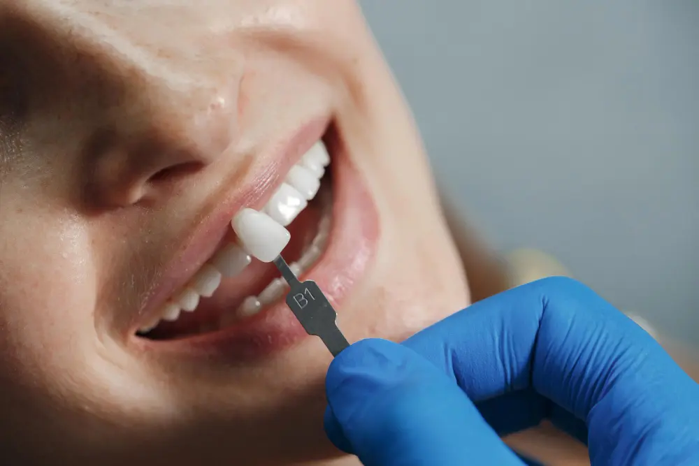 Single tooth implant