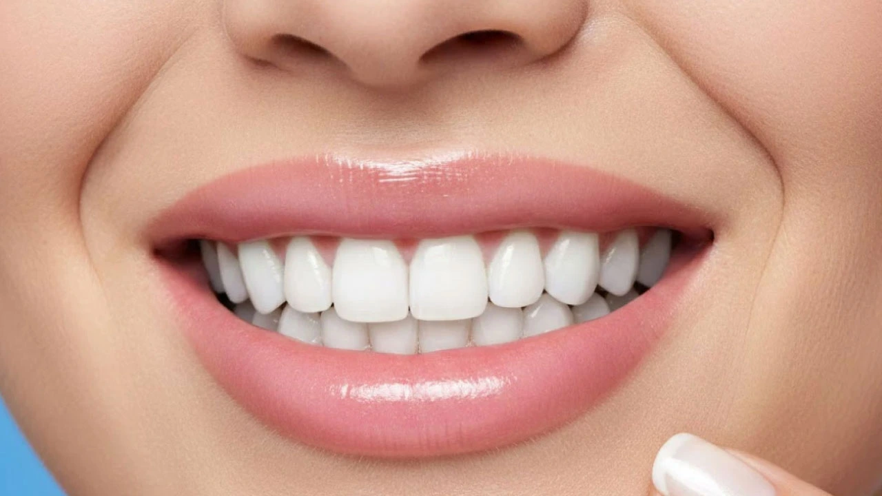 Smile Teeth Whitening
