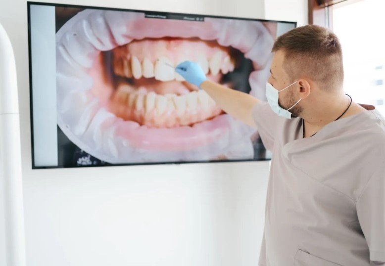 why do gum grafts fail