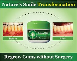Natures Smile Transmission
